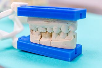 Cosmetic Dentistry