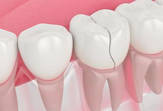 Emergency Dentistry
