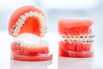 Orthodontics